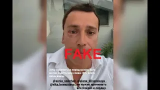 Максим Галкин показал свое лицо после новости о нападении на него