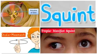 Squint 1: Extraocular Muscles Origin and Insertion,Nerve and Blood Supply