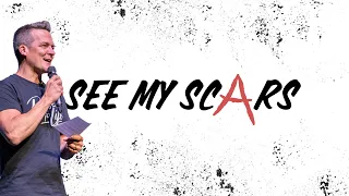 See My Scars | May 26 | 11a