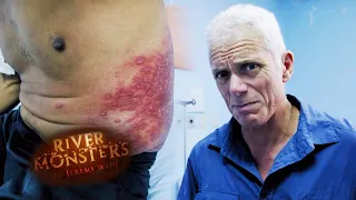 Victim Of An Agonising Parasite | River Monsters