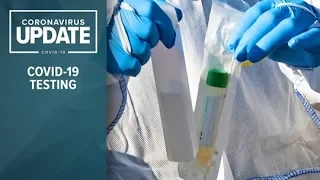 WATCH LIVE: UW gives update on COVID-19 antibody testing