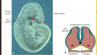 Ear Devvelopment (ADL)