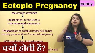 Ectopic Pregnancy in Hindi | Sites of Implantations | Risk Factors | Nursing Lecture