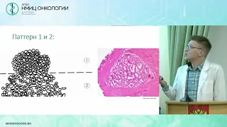 Причины ошибок при верификации рака предстательной железы: анализ патоморфолога