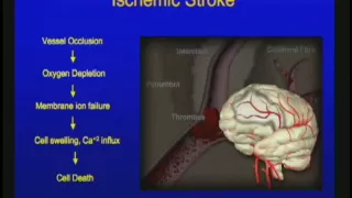 Vascular Disorders of the Central Nervous System