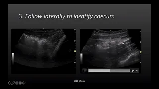 Pattern and process recognition in GUT PoCUS