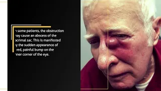 Diagnosing and treating a lacrimal duct obstruction