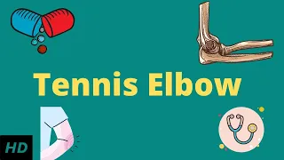 Tennis elbow, Causes, Signs and Symptoms, Diagnosis and Treatment.