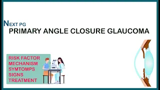 PRIMARY ANGLE CLOSURE GLAUCOMA | Ophthalmology lectures | NEET PG  NOTES