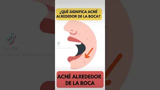 Qué significa el acné alrededor de la boca?