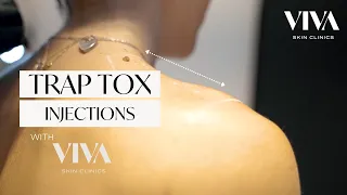 TRAP TOX TREATMENT WITH INJECTIONS | BARBIE BOTOX | VIVA 2024