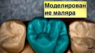 Моделирование моляра верхней челюсти. Как отмоделировать зуб. Изготовление зубов.