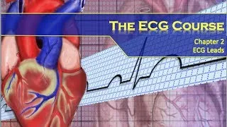 The ECG Course - Leads