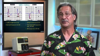 Hippo Short: RBBB vs LBBB on an ECG