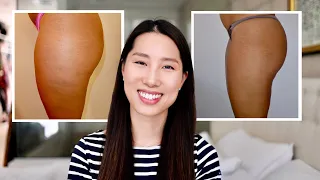 how to get rid of cellulite | a proven effective method | Chris Han