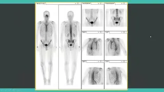 Crash course in nuclear medicine for radiology exam preparation