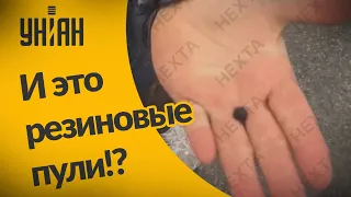 Протестующая в Беларуси показала, какими пулями по людям стреляет ОМОН