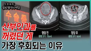 난소암, 첫수술이 생존율을 결정한다는데...수술과 함께 진단, 치료법이 결정되는 난소암과의 사투 (KBS 20230802 방송)