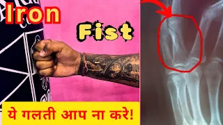 Iron fist in martial arts training in Hindi || How to do practice for iron fist karate MMA boxing🥊