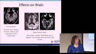 It's Time to Talk About It: Eating Disorders in Late Childhood and Preteens