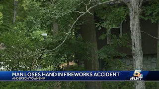 Man loses hand in fireworks accident