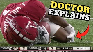 You Could See the ACL Pop - Doctor Explains Jameson Williams Knee Injury