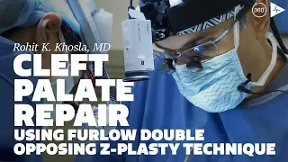 Cleft Palate Repair using Furlow Double Opposing Z-plasty Technique by Dr. Khosla | Case Trailer