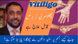 Phulbehri (Vitiligo) Treatment | Sufaid daagh Ka ilaj | @AureusHealthCare @AimilHealthcare