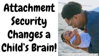 Security of Infant Attachment Impacts Brain Development