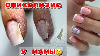 ОНИХОЛИЗИС на ногтях 😐 ФРЕНЧ опаловыми гелями 💅 Маникюр