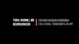 Foramen Magnum Meningioma - Far Lateral Transcondylar approach.