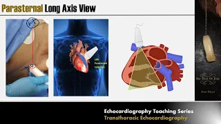 Lecture 2 - Transthoracic Echocardiography Part 1