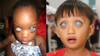 5 Extremely Rare Kids From Around The World