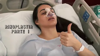 MEU RELATO DE RINOPLASTIA | Parte 1