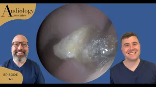 EAR WAX COCOON REMOVAL - EP822