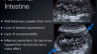 Gallbladder and Intestinal Ultrasound