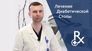 Восстановление артерий нижней конечности при синдроме диабетической стопы.