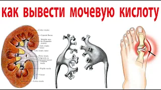 Все Врачи пьют этот чай. Снижает уровень мочевой кислоты и лечит подагру