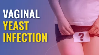 Vaginal Yeast Infection | Symptoms & Treatment for Vaginal Yeast Infection | MFine