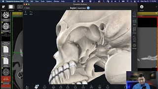 The Ins and Outs of the Pterygopalatince Fossa