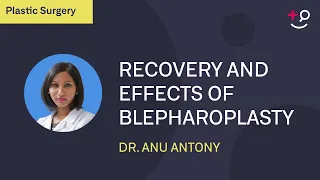 Recovery and effects of blepharoplasty: what can you expect?