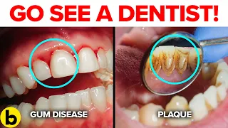 7 Dental Problems You Need To Watch Out For