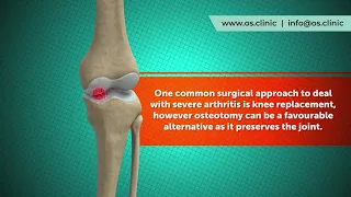 What is an knee osteotomy?