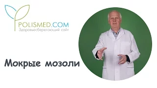 Мокрые (кровавые) мозоли: причины, симптомы, лечение, обработка, профилактика