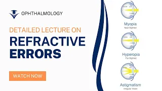 Understanding Refractive Errors in Ophthalmology: A Comprehensive Lecture