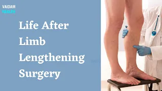 Life After Limb Lengthening Surgery