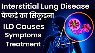 Interstitial Lung Disease फेफड़े का सिकुड़ना ILD Causes  Symptoms  Treatment