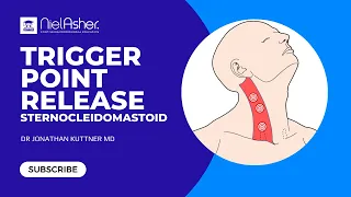 Trigger Point Therapy - Sternocleidomastoid (SCM)