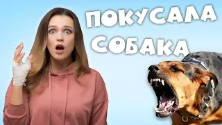 МЕНЯ ПОКУСАЛА СОБАКА!!! |  ЧЕМ ЭТО ОПАСНО? ЧТО ДЕЛАТЬ , ЕСЛИ УКУСИЛА СОБАКА?