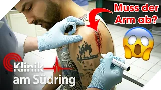 Amputation? 😱 Bodybuilder bangt wegen eitriger Wunde um seinen Arm 💪🏻 | Klinik am Südring | SAT.1
